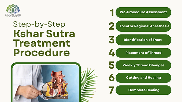 Step-by-Step Kshar Sutra Treatment Procedure