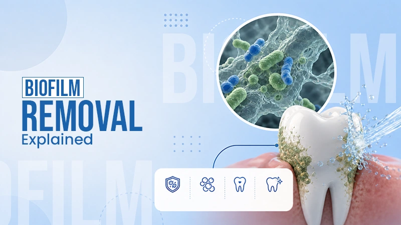 The Science Behind Biofilm Removal: Why It Matters